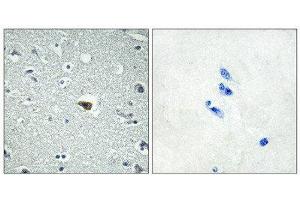 Immunohistochemistry (IHC) image for anti-Brain-Specific Angiogenesis Inhibitor 1 (BAI1) (Internal Region) antibody (ABIN5978285) (BAI1 Antikörper  (Internal Region))