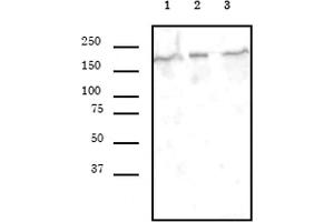 SMARCA4 antibody (mAb) (Clone 5B7) tested by Western blot. (SMARCA4 Antikörper  (AA 213-295))