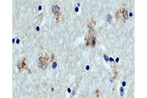 DAB staining of ATG5 in paraffin - embedded human brain section (midfrontal cortex, Alzheimer case) using rabbit ATG5 polyclonal antibody  . (ATG5 Antikörper  (C-Term))