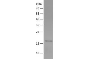 Western Blotting (WB) image for Creatine Kinase, Muscle (CKM) (AA 1-162) protein (His tag) (ABIN7283377) (CKM Protein (AA 1-162) (His tag))