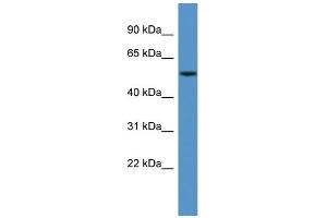 Western Blotting (WB) image for anti-Cytochrome P450, Family 3, Subfamily A, Polypeptide 5 (CYP3A5) (N-Term) antibody (ABIN2788347)
