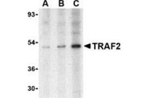 Western blot analysis of TRAF2 in human liver tissue lysate with this product at (A) 0. (TRAF2 Antikörper  (N-Term))