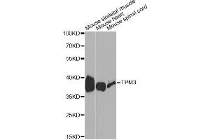 Western blot analysis of extracts of various cell lines, using TPM3 antibody (ABIN1875182) at 1:1000 dilution. (TPM3 Antikörper)