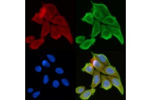 ABIN6260885 and ABIN6268761 staining Hela cells(30 min of UV treatment) by IF/ICC. (Claudin 6 Antikörper  (Internal Region))