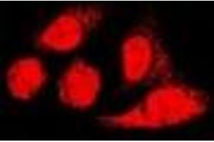 Immunofluorescent analysis of PA28 alpha staining in U2OS cells. (PSME1 Antikörper)
