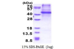 SDS-PAGE (SDS) image for Breast Cancer Anti-Estrogen Resistance 1 (BCAR1) (AA 465-848) protein (His tag) (ABIN5853517) (BCAR1 Protein (AA 465-848) (His tag))