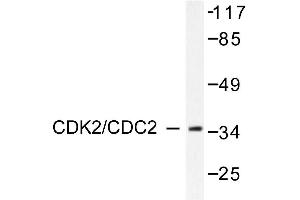 Image no. 1 for anti-Cyclin-Dependent Kinase 2 (CDK2) antibody (ABIN265345) (CDK2 Antikörper)