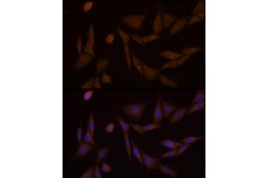 Immunofluorescence analysis of NIH/3T3 cells using PFKFB3 Rabbit mAb (ABIN1680620, ABIN3018306, ABIN3018307 and ABIN7101590) at dilution of 1:100 (40x lens). (PFKFB3 Antikörper)