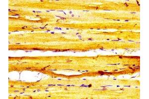 IHC image of ABIN7160609 diluted at 1:600 and staining in paraffin-embedded human skeletal muscle tissue performed on a Leica BondTM system. (MYBPC1 Antikörper  (AA 618-779))