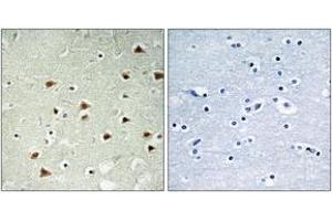 Immunohistochemistry (IHC) image for anti-Abhydrolase Domain Containing 14B (ABHD14B) (AA 161-210) antibody (ABIN2890083) (ABHD14B Antikörper  (AA 161-210))