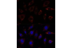 Immunofluorescence (IF) image for anti-Transforming Growth Factor beta Regulator 4 (TBRG4) (AA 382-631) antibody (ABIN7270907)