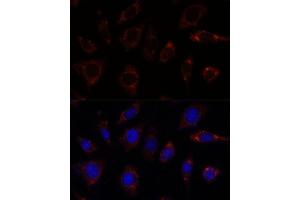 Immunofluorescence analysis of L929 cells using TBRG4 antibody  at dilution of 1:100. (TBRG4 Antikörper  (AA 382-631))