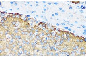 Immunohistochemistry of paraffin-embedded Mouse pancreatic islet using TSC1 Polyclonal Antibody at dilution of 1:200 (40x lens). (TSC1 Antikörper)