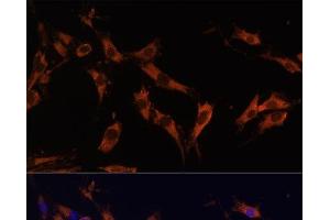 Immunofluorescence analysis of C6 cells using KSR1 Polyclonal Antibody at dilution of 1:100 (40x lens). (KSR1 Antikörper)