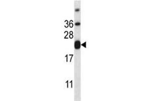 Western Blotting (WB) image for anti-CD3 epsilon (CD3E) (AA 154-182) antibody (ABIN3030389)