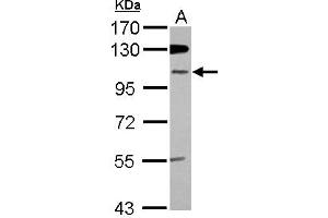 Western Blotting (WB) image for anti-Zinc Finger Protein 512B (ZNF512B) (Internal Region) antibody (ABIN1493532) (ZNF512B Antikörper  (Internal Region))