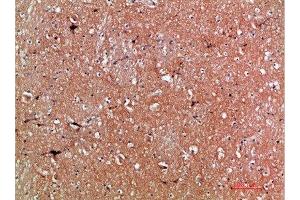 Immunohistochemical analysis of paraffin-embedded human-brain, antibody was diluted at 1:200 (Tenascin R Antikörper  (AA 1270-1350))