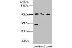 Western blot All lanes: SLC38A6 antibody at 12 μg/mL Lane 1: Mouse kidney tissue Lane 2: Mouse thymus tissue Lane 3: U87 whole cell lysate Secondary Goat polyclonal to rabbit IgG at 1/10000 dilution Predicted band size: 51, 58 kDa Observed band size: 51, 33 kDa (SLC38A6 Antikörper  (AA 132-169))
