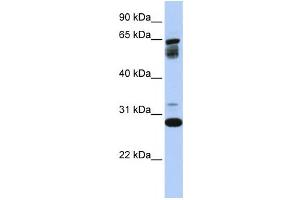 Western Blotting (WB) image for anti-Transmembrane Protein 187 (TMEM187) antibody (ABIN2458936)