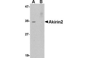 Western Blotting (WB) image for anti-Akirin 2 (AKIRIN2) (Middle Region 2) antibody (ABIN1031196)