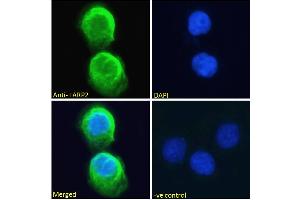 ABIN190867 Immunofluorescence analysis of paraformaldehyde fixed A431 cells, permeabilized with 0. (LARP1B Antikörper  (Internal Region))