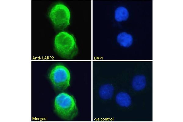 LARP1B Antikörper  (Internal Region)