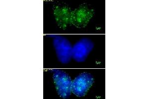 Histone H3 trimethyl Lys9 mAb (Clone 2AG-6F12-H4) tested by immunofluorescence. (Histone 3 Antikörper  (H3K9me3))