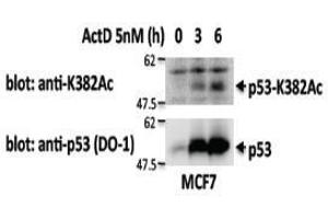 Western Blotting (WB) image for anti-Tumor Protein P53 (TP53) antibody (ABIN1449253) (p53 Antikörper)
