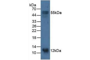 Detection of S100A14 in Porcine Stomach Tissue using Polyclonal Antibody to S100 Calcium Binding Protein A14 (S100A14)