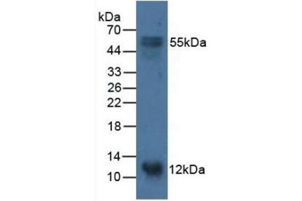 S100A14 Antikörper  (AA 1-91)