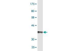 Western Blot detection against Immunogen (36. (ABCB6 Antikörper  (AA 743-842))