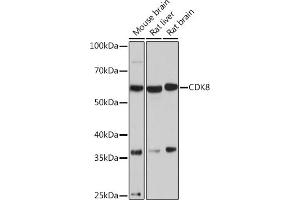 Western blot analysis of extracts of various cell lines, using CDK8 Rabbit mAb (ABIN7266596) at 1:1000 dilution. (CDK8 Antikörper)