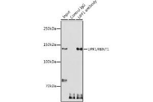 Immunoprecipitation analysis of 300 μg extracts of HeLa cells using 3 μg UPF1/RENT1 antibody (ABIN3022068, ABIN3022069, ABIN3022070 and ABIN6218593).