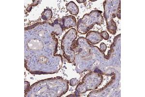 Immunohistochemical staining of human placenta with PTCD2 polyclonal antibody  shows strong cytoplasmic positivity in trophoblastic cells. (PTCD2 Antikörper)