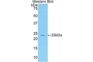 Western blot analysis of the recombinant protein. (Vitamin D-Binding Protein Antikörper  (AA 18-211))