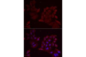Immunofluorescence analysis of MCF7 cells using Pannexin 1 antibody (ABIN6128523, ABIN6145204, ABIN6145206 and ABIN6217644). (PANX1 Antikörper  (AA 297-426))