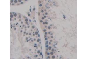 IHC-P analysis of Kidney tissue, with DAB staining. (NEK2 Antikörper  (AA 125-393))