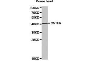 Western Blotting (WB) image for anti-Ciliary Neurotrophic Factor Receptor (CNTFR) antibody (ABIN1871941) (CNTF Receptor alpha Antikörper)