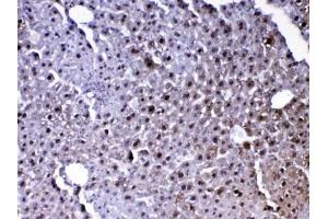IHC testing of FFPE mouse liver tissue with Park7 antibody at 1ug/ml. (PARK7/DJ1 Antikörper)