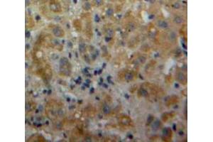 IHC-P analysis of Liver tissue, with DAB staining. (IL-17 Antikörper  (AA 20-155))