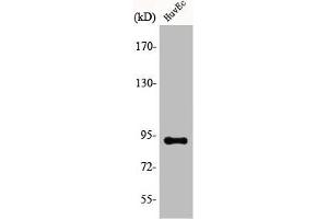 Western Blot analysis of COLO205 cells using AKAP 149 Polyclonal Antibody (AKAP1 Antikörper  (Internal Region))