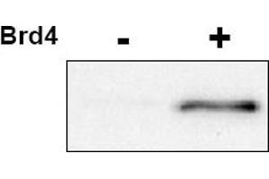 Image no. 1 for anti-Cyclin-Dependent Kinase 9 (CDK9) (pThr29) antibody (ABIN401390) (CDK9 Antikörper  (pThr29))