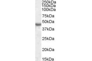 Image no. 1 for anti-Potassium Inwardly-Rectifying Channel, Subfamily J, Member 1 (KCNJ1) (AA 245-259) antibody (ABIN490492)
