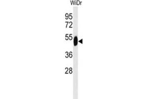 Western Blotting (WB) image for anti-SET Domain Containing 6 (SETD6) antibody (ABIN3002146) (SETD6 Antikörper)