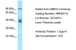 WB Suggested Anti-L3MBTL3 Antibody Titration:  0. (L3MBTL3 Antikörper  (N-Term))