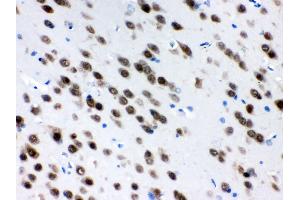Anti- ELAVL4 Picoband antibody, IHC(P) IHC(P): Rat Brain Tissue