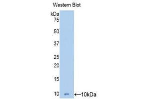 Western Blotting (WB) image for anti-Mucin 5 Subtype B (MUC5B) (AA 5366-5444) antibody (ABIN1078357)