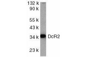 Western blot analysis of DcR2 in HeLa cell lysate with DcR2 antibody at 1ug/ml. (DcR2 Antikörper)