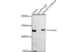 Immunoprecipitation analysis of 300 μg extracts of HeLa cells using 3 μg Vinculin antibody (ABIN3016604, ABIN3016605, ABIN1680530 and ABIN1680531). (Vinculin Antikörper)