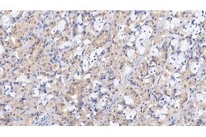 Detection of WTAP in Human Stomach Tissue using Polyclonal Antibody to Wilms Tumor 1 Associated Protein (WTAP) (WTAP Antikörper  (AA 1-150))